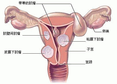 而未育<em>女性得不到</em>孕激素及时有效保护