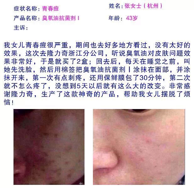 隆力奇臭氧油抗菌剂