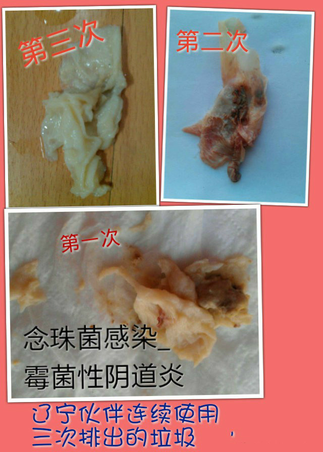 隆力奇花清丹多少钱